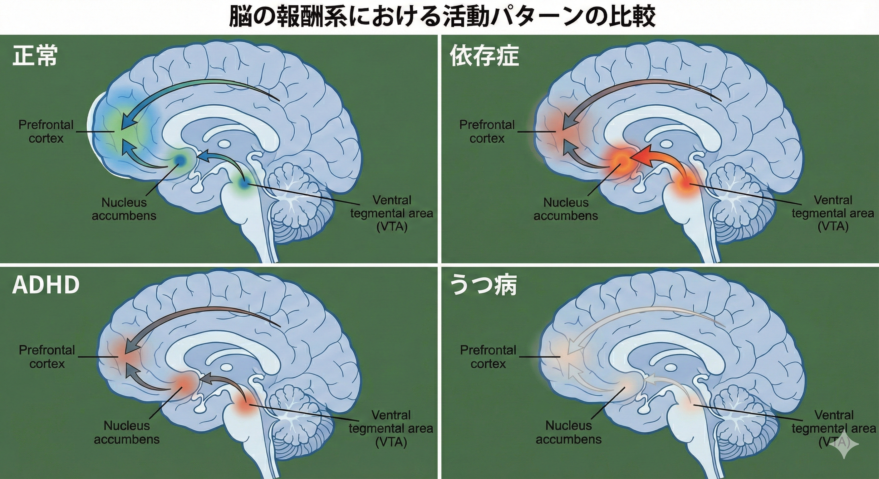 ドーパミンシリーズ8：ドーパミンと精神疾患：依存症・ADHD・うつ病～報酬系の機能異常と治療～