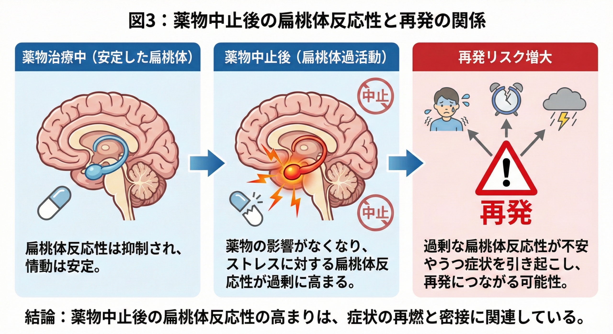 抗うつ薬中止後の扁桃体反応性変化と再発リスクの関係を示す概念図